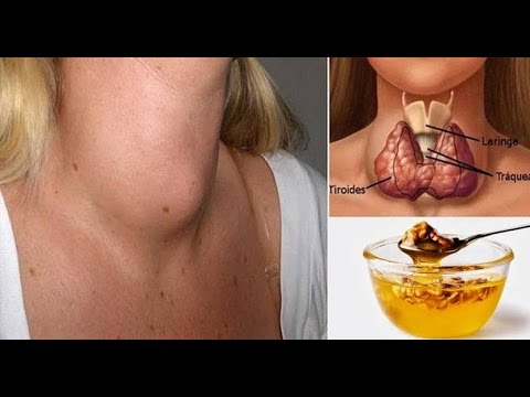Film su alcolizzati di madri Alcolismo le medicine che causano il disgusto per alcool