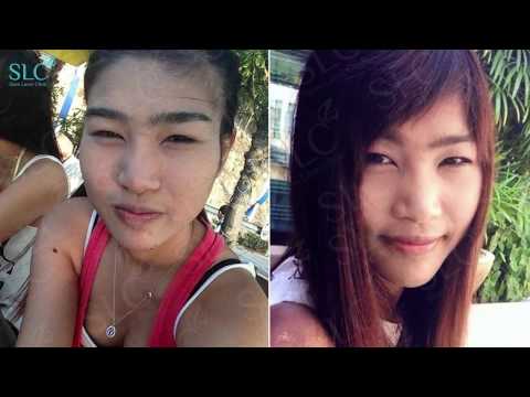 หน้าอกเล็กขนาดใหญ่ที่แตกต่างกัน การ์ตูนเสริมเต้านม