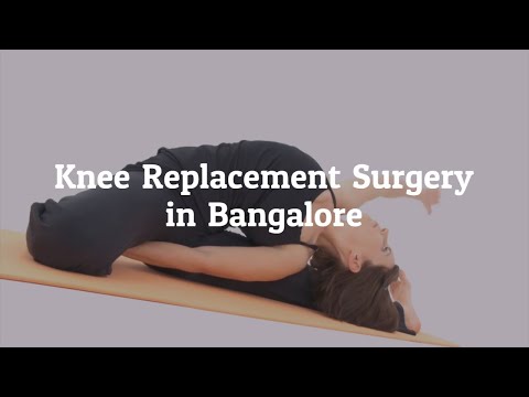 Important Facts About Knee Replacement Surgery in Bangalore