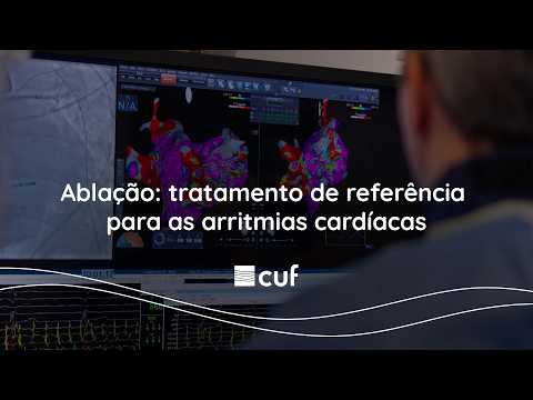 Ablação arritmias CUF