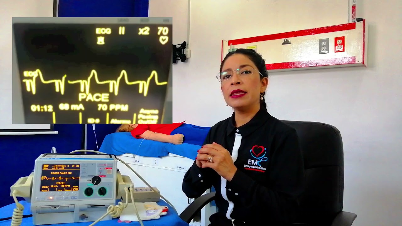 Watch Uso de desfibrilador en modo marcapasos. Now Uso de desfibrilador en modo marcapasos.