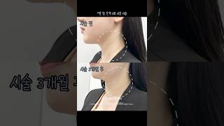 목주름 관리 '이렇게' 해보세요💯