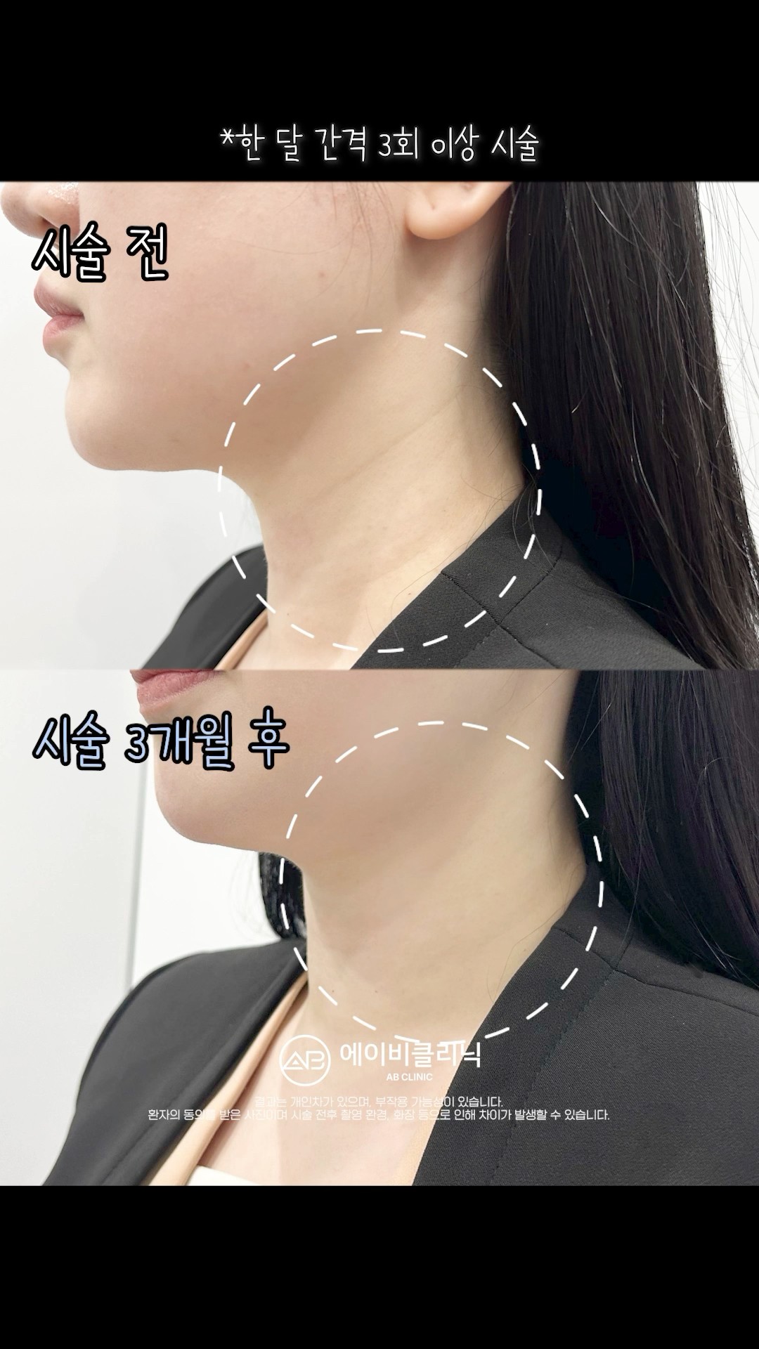 목주름 관리 '이렇게' 해보세요💯