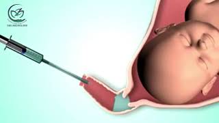 GYNOTAL OBSTETRIC GEL STERILE