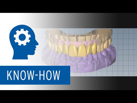 Simple, Predictable, Fast - Monolithic Esthetics with Zolid FX Multilayer Zirconia