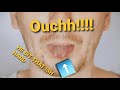 Why Do I Bite My Tongue and Cheek?