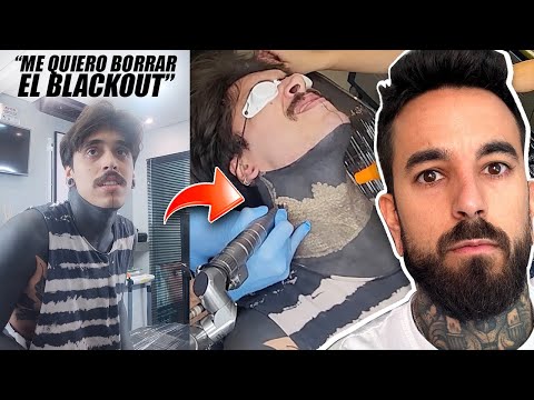 El BLACKOUT YA es una MODA y este es el RESULTADO 🤕