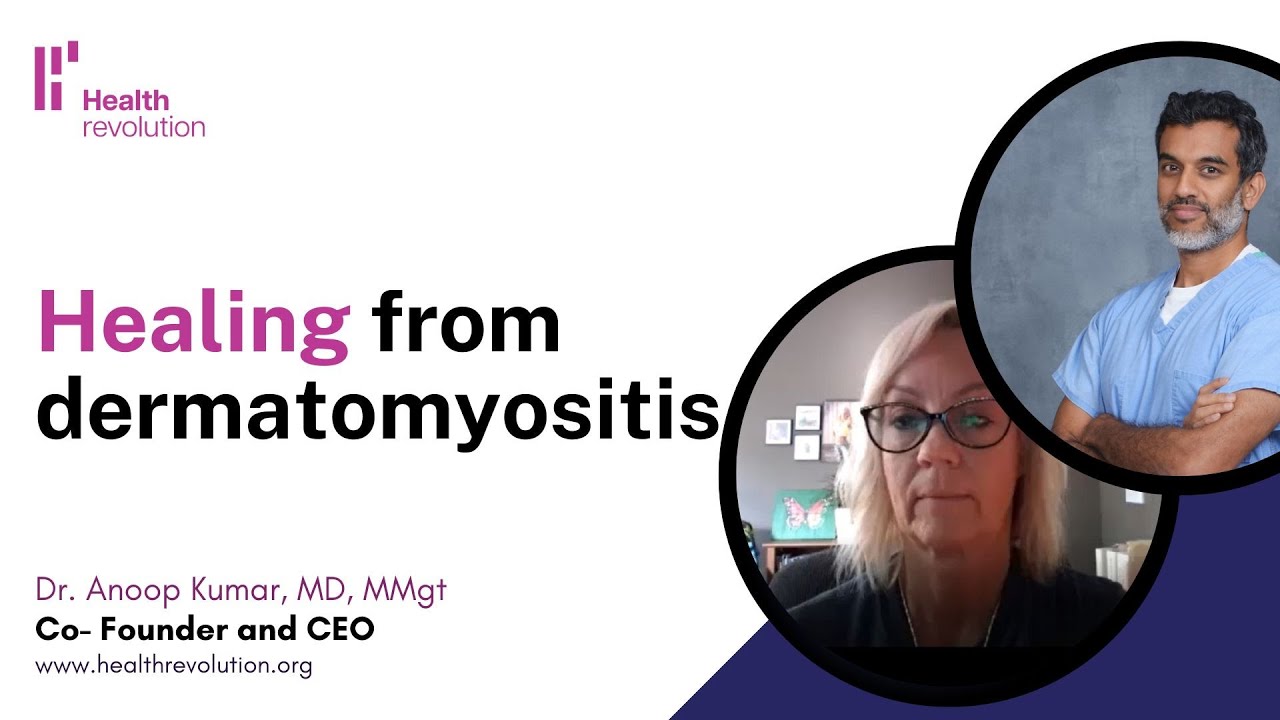 Healing from dermatomyositis