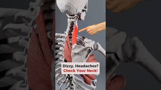 Download lagu Begini cara memeriksa apakah LEHER Anda penyebab Sakit Kepala   Pusing! #pusing #sakitkepala #nye... mp3