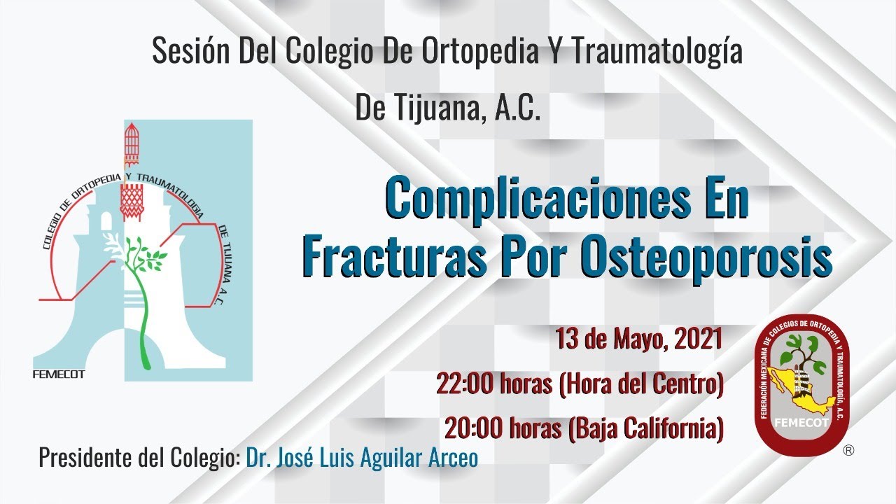 Putar video Complicaciones En Fracturas Por Osteoporosis sekarang Complicaciones En Fracturas Por Osteoporosis