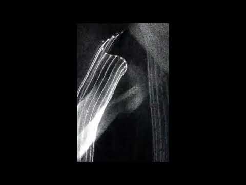 [FREE] SUPERTRAP X REDDA X DARKSPIN TYPE BEAT - "WITCHER" [Prod. Grracz]