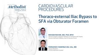 Download Lagu Thoraco-external Iliac Bypass to SFA via Obturator Foramen (Rahimi, MD, Ramirez Del Val, MD) Thumbnail