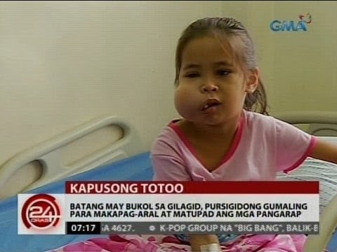 Mawalan ng Timbang sa mga pinakabagong release ng NTV YouTube Clay slimming pambalot na may film