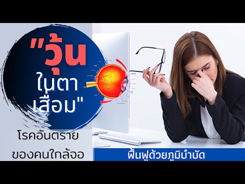 ทิงเจอร์เห็ดโรคสะเก็ดเงิน ความคิดเห็น Ovesol สำหรับโรคสะเก็ดเงิน