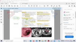 GIT 9- A-Diverticula of the GI tract -- Ibrahem Gamal -Toxic usmle - شرح المعادلة الامريكية بالعربي