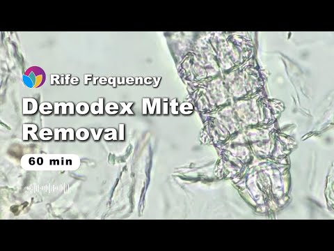 “Stop Scratching NOW” | 72hr Mite Purge Protocol | Rife Frequency BLASTS Demodex Colonies