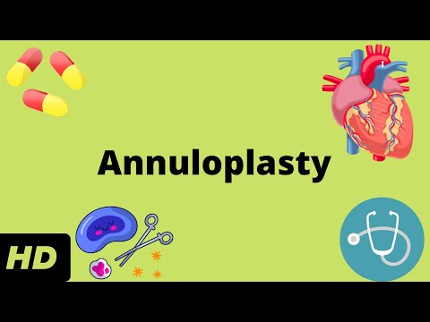 All About Allergy Shots