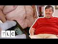 Chris Struggles With Loose Skin After MASSIVE Weight Loss | 1000-lb Sisters