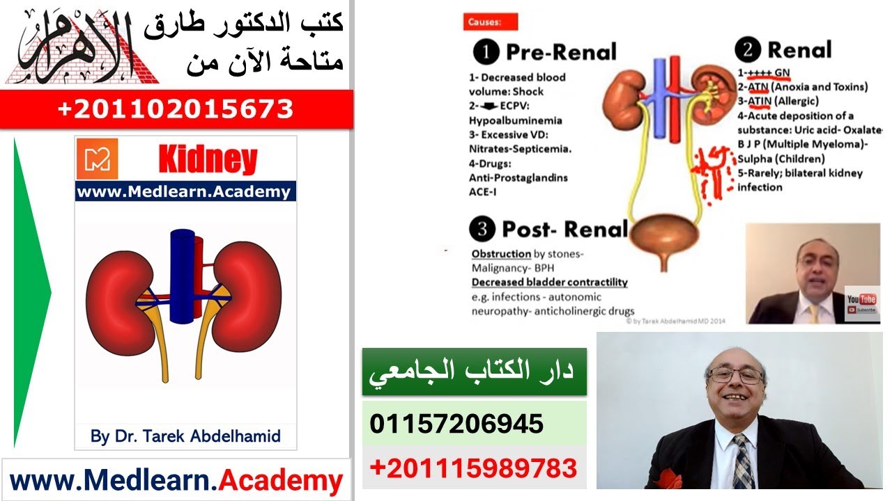 Acute Renal Failure  (ARF)   #cme #internal_medicine  #usmle #medical #محاضرات_باطنة