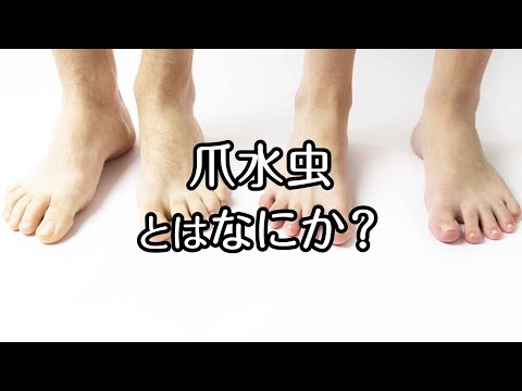 アグラオフェニア sp.クロアチアで
