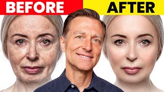 The Ultimate Face Transformation–Dr. Berg