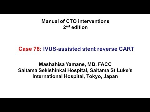 Case 78: Manual of CTO Interventions - Retrograde via ipsilateral collateral