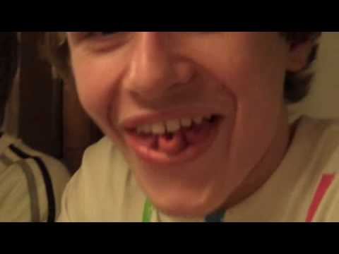 Zungenakrobatik Philip