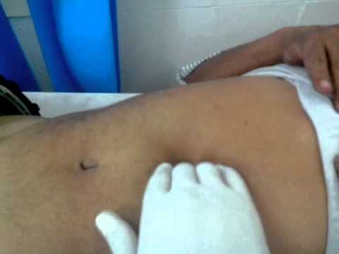 Diyeta sa mawala timbang sa baywang Kung paano manipis ang nangungunang bahay 2 Borodin