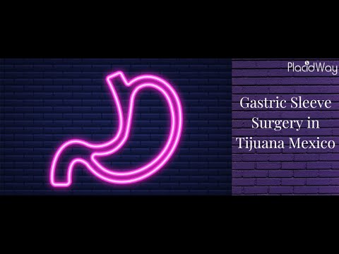 Watch Gastric Sleeve Surgery in Tijuana, Mexico