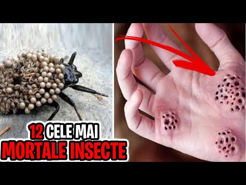 , title : '12 Cele Mai MORTALE Insecte'