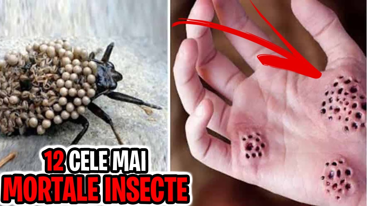 12 Cele Mai MORTALE Insecte