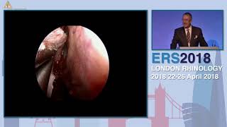 Download Lagu ERS London 2018, Technique - State Of The Art In The 21st Century, Daniel Simmen Thumbnail