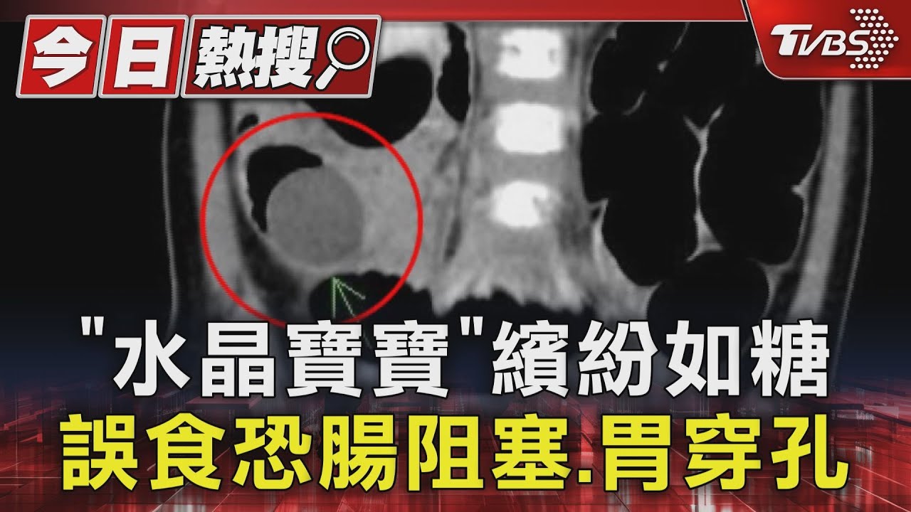 兒童誤食風險高! 水晶寶寶膨脹20倍「恐致腸穿孔」專家警告