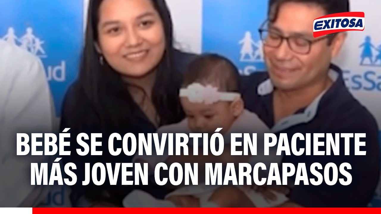 🔴🔵 Bebé Aitana se convirtió en la paciente más pequeña de Latinoamérica en recibir un marcapasos