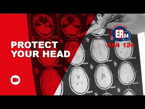 Head Injuries: Tips on how to protect your head