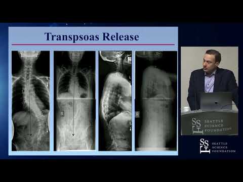 Outcomes of Adult Spinal Deformity Surgery - Justin S. Smith, MD, PhD
