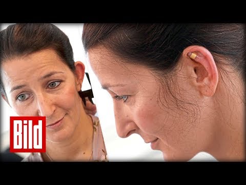 Ohren anlegen in 20 Minuten - Schnelle OP gegen Segelohren