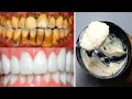 Teeth whitening at home in 3 minutes || How to naturally whiten your yellow teeth || 100% effective Teeth whitening at home in 3 minutes || How to naturally whiten your yellow teeth || 100% effective