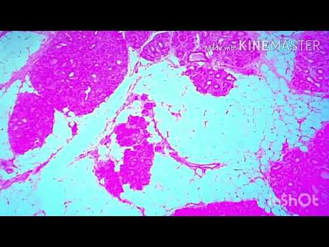 Real slide of adipose tissue in 4x,10x and 40x