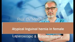Miniaturka - Atypical Inguinal hernia in female. Metin Ertem MD. FACS