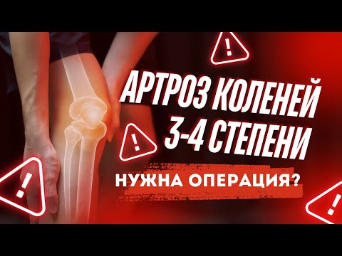Артроз 3-4 степени. Мнение врача об операции. Эндопротезирование