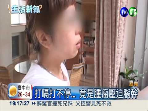 打嗝打不停... 竟是腫瘤壓迫腦幹