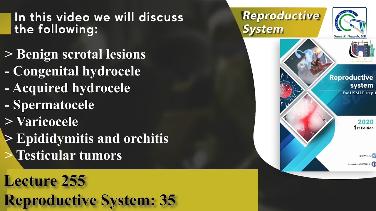 Hydrocele | Spermatocele | Varicocele | Epididymitis and orchitis | Testicular tumors