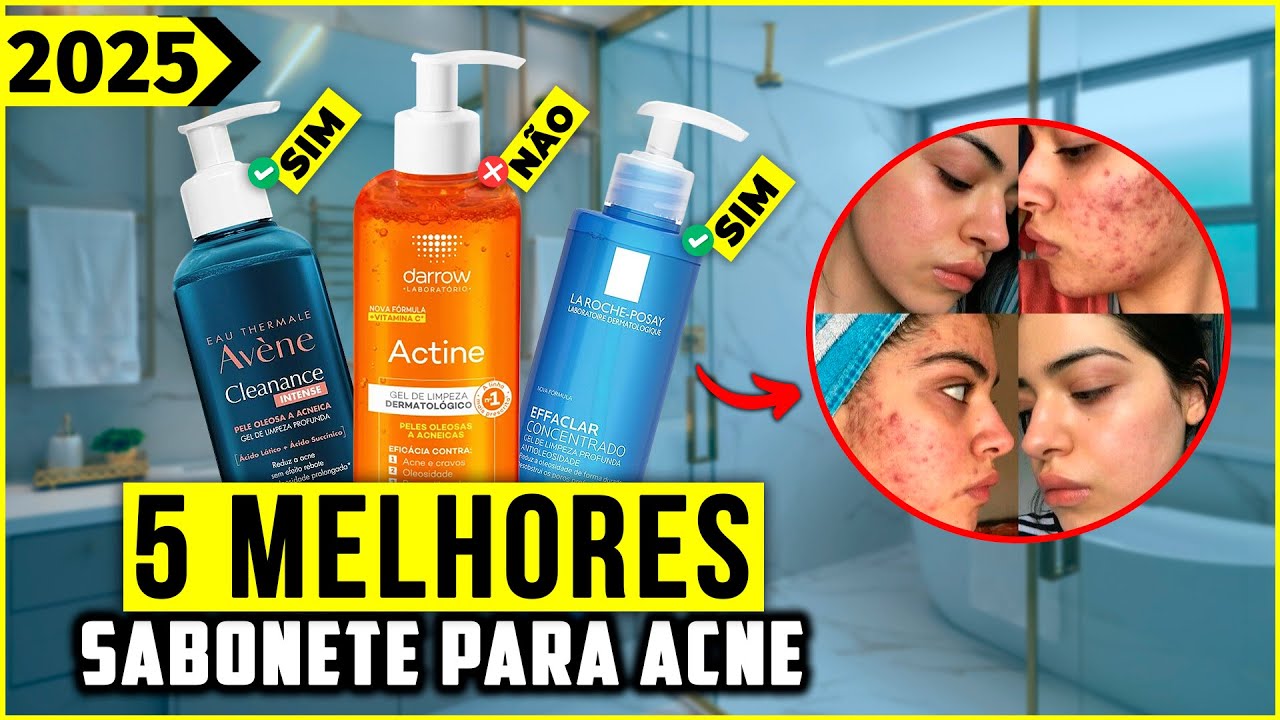 Os 5 Melhores Sabonete Para Acne/ Sabonete Para Espinhas Em 2024!