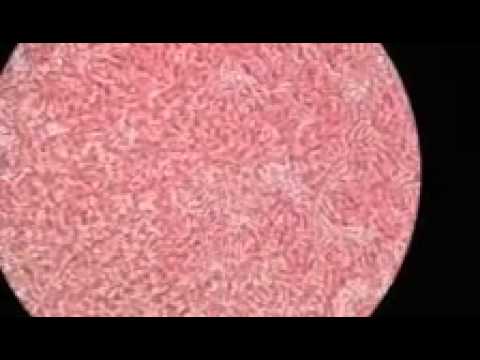 Heart worm Caught on Camera