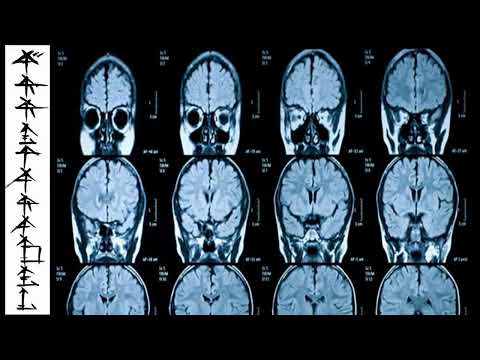 19.Irreparabel315 und Egoshoo7er - Psychopathie!!!