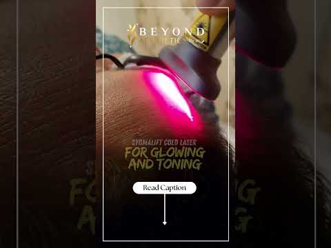 Sygmalift Cold laser for Glowing and Toning | Beyond Aesthetics Ns3