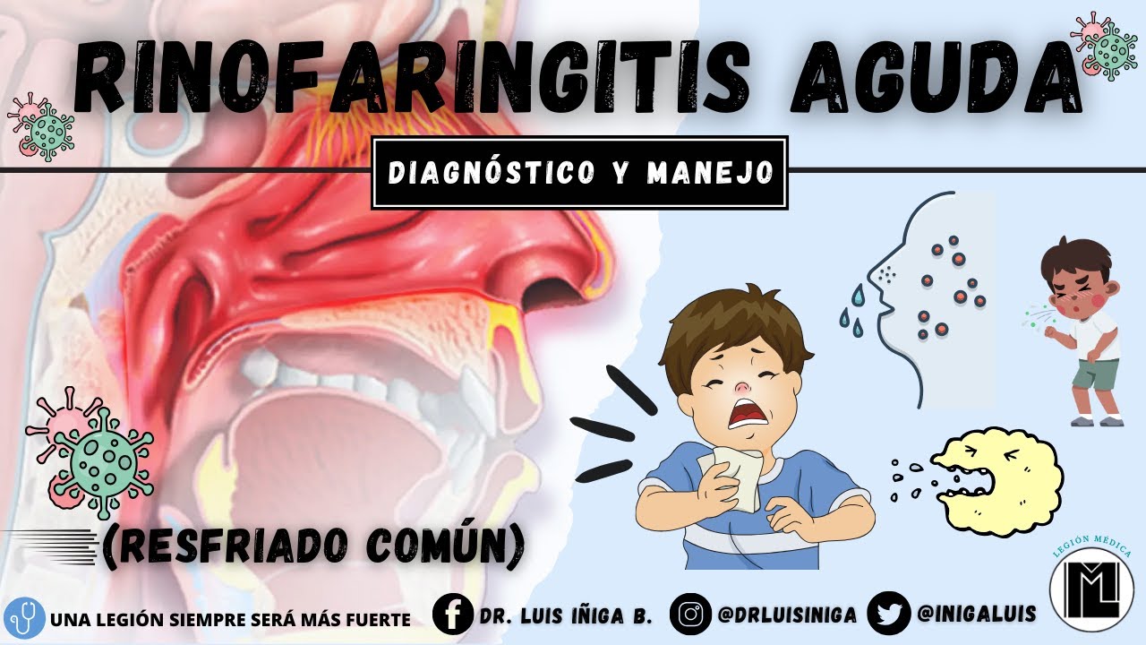 Rinofaringitis aguda (resfriado común) | Etiología, Patogenia, Clínica, Diagnóstico y Tratamiento