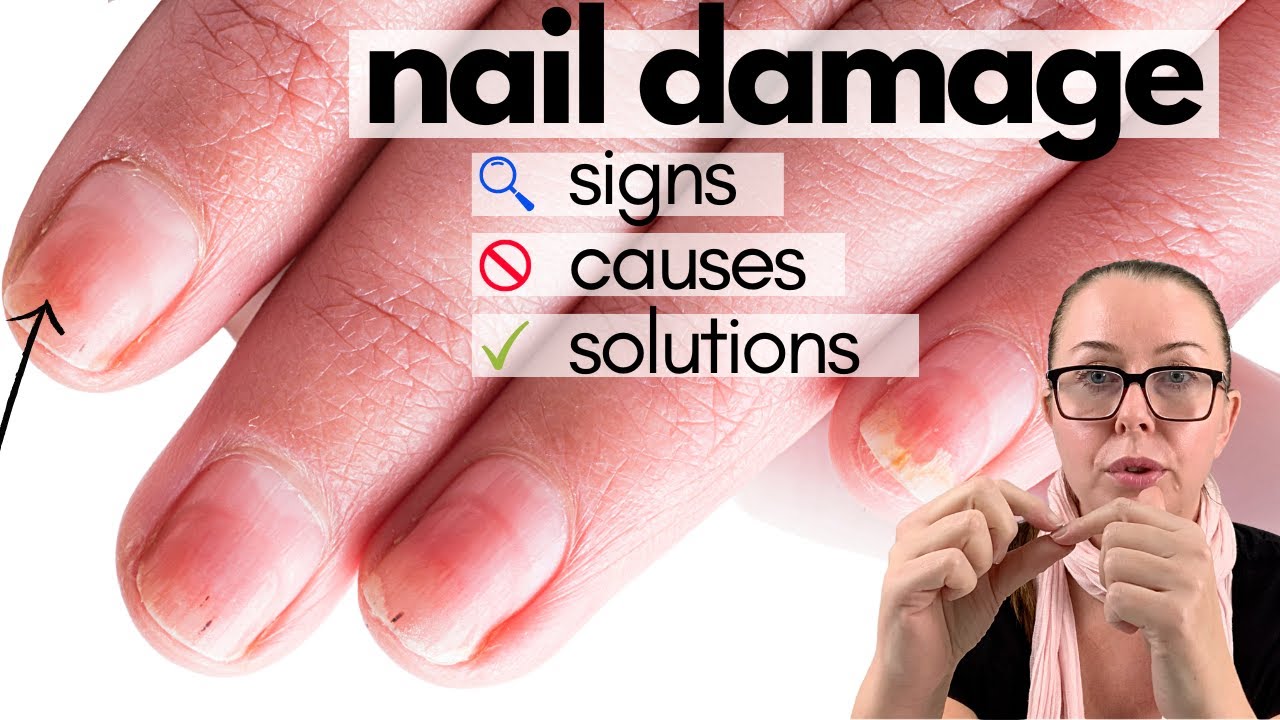 You took off Acrylics, Gels or Dip nails and discovered DISASTER. What's next?