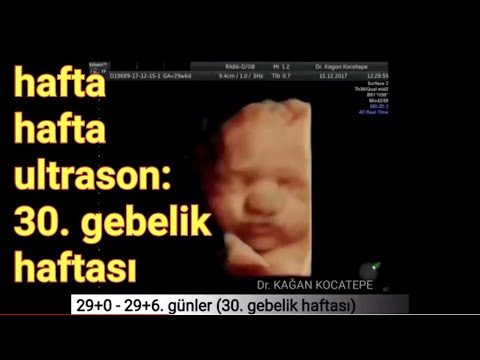30. gebelik haftasında anne karnındaki bebek - açıklamalı ultrason görüntüleri (bebeğin kilosu)